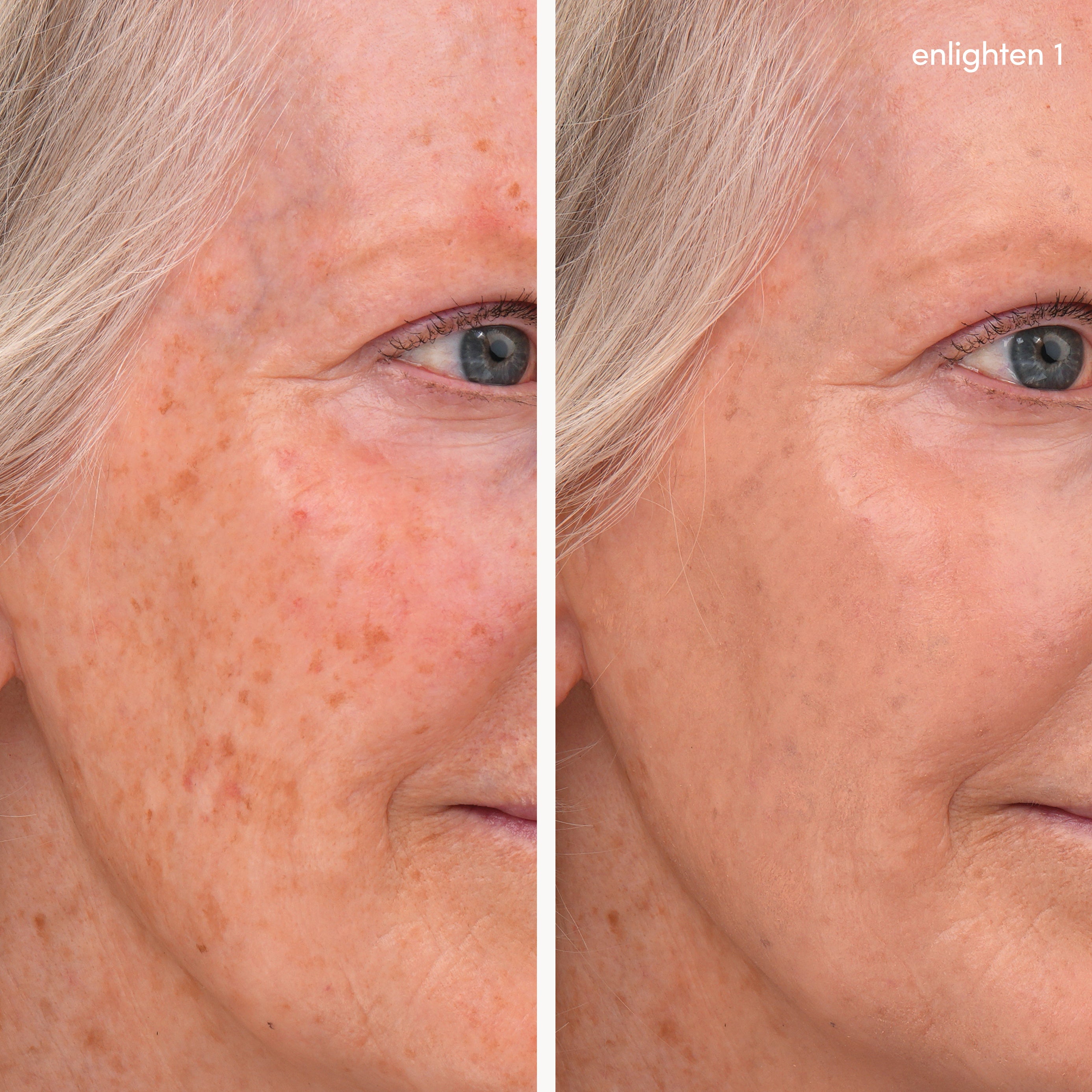 Enlighten Concealer™ 6