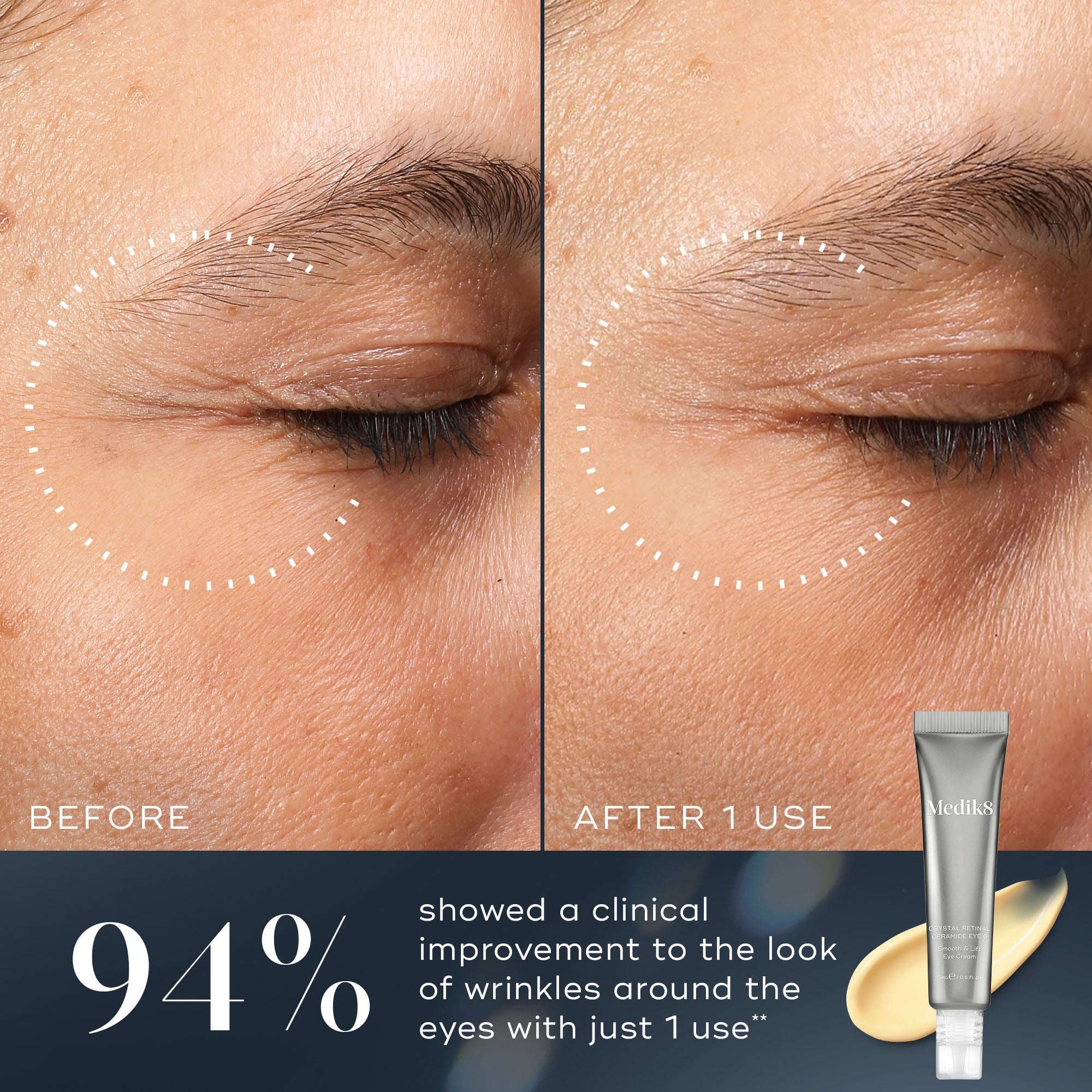 Crystal Retinal® Ceramide Eye 10 6