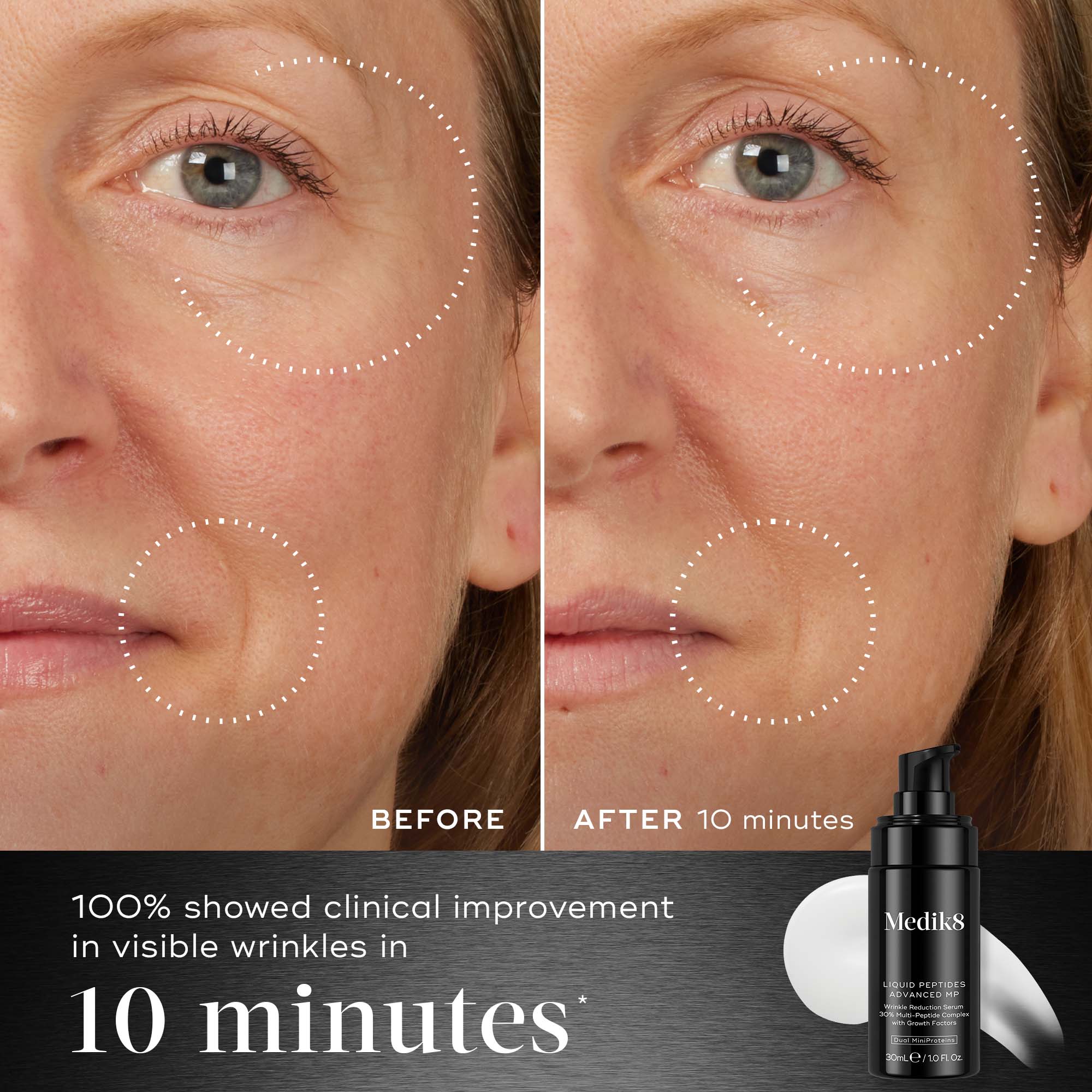 Liquid Peptides Advanced MP 4