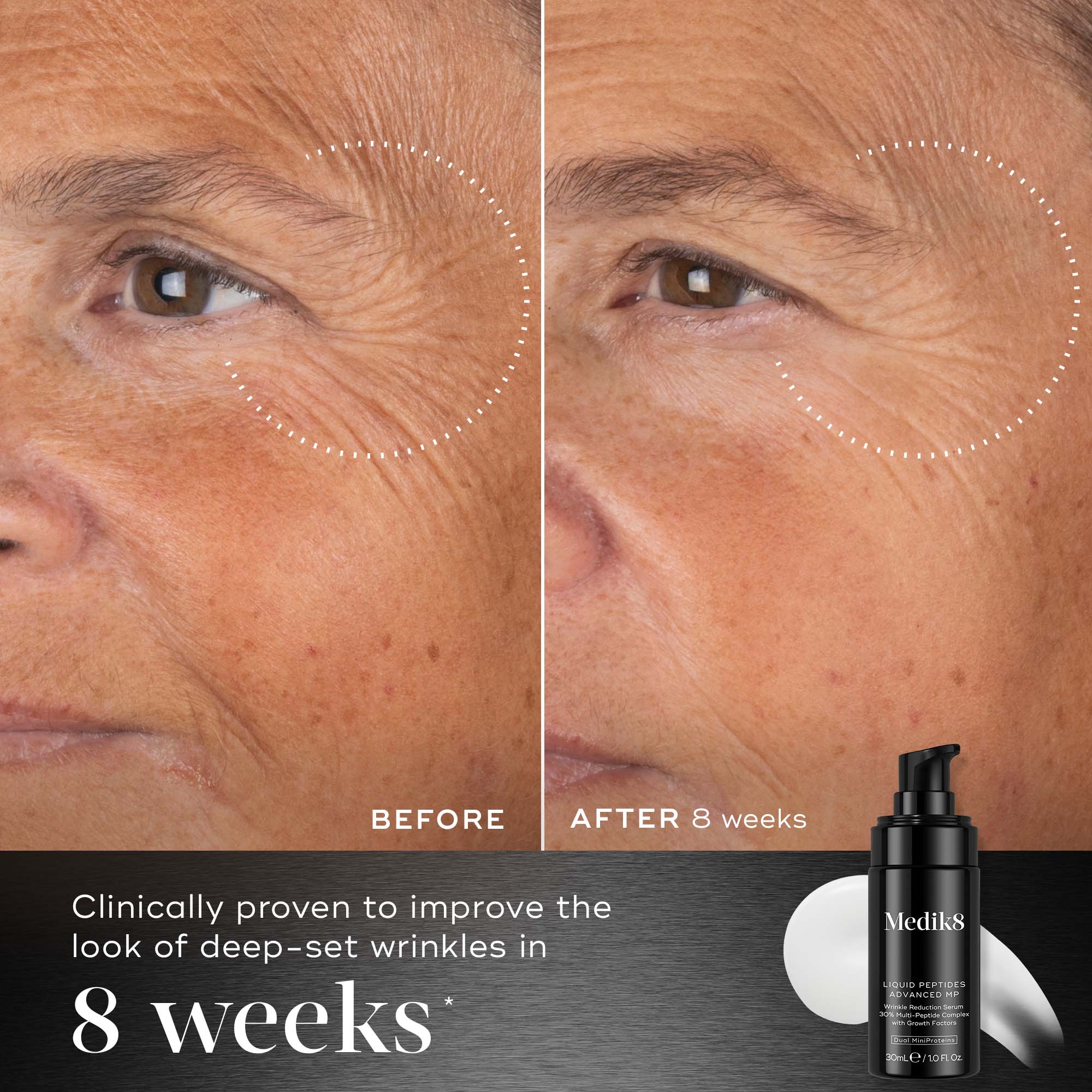 Liquid Peptides Advanced MP 5
