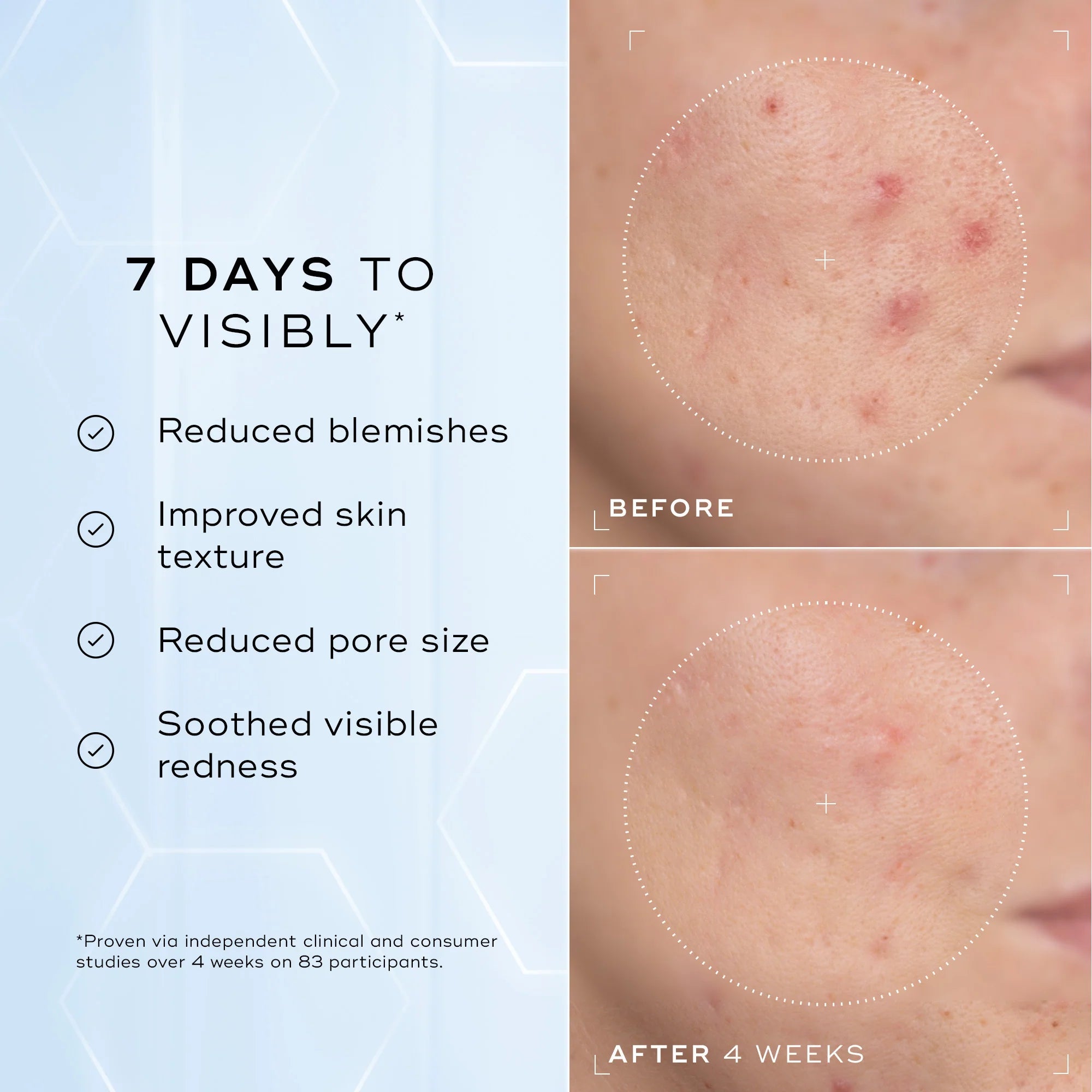 Niacinamide Peptides 3