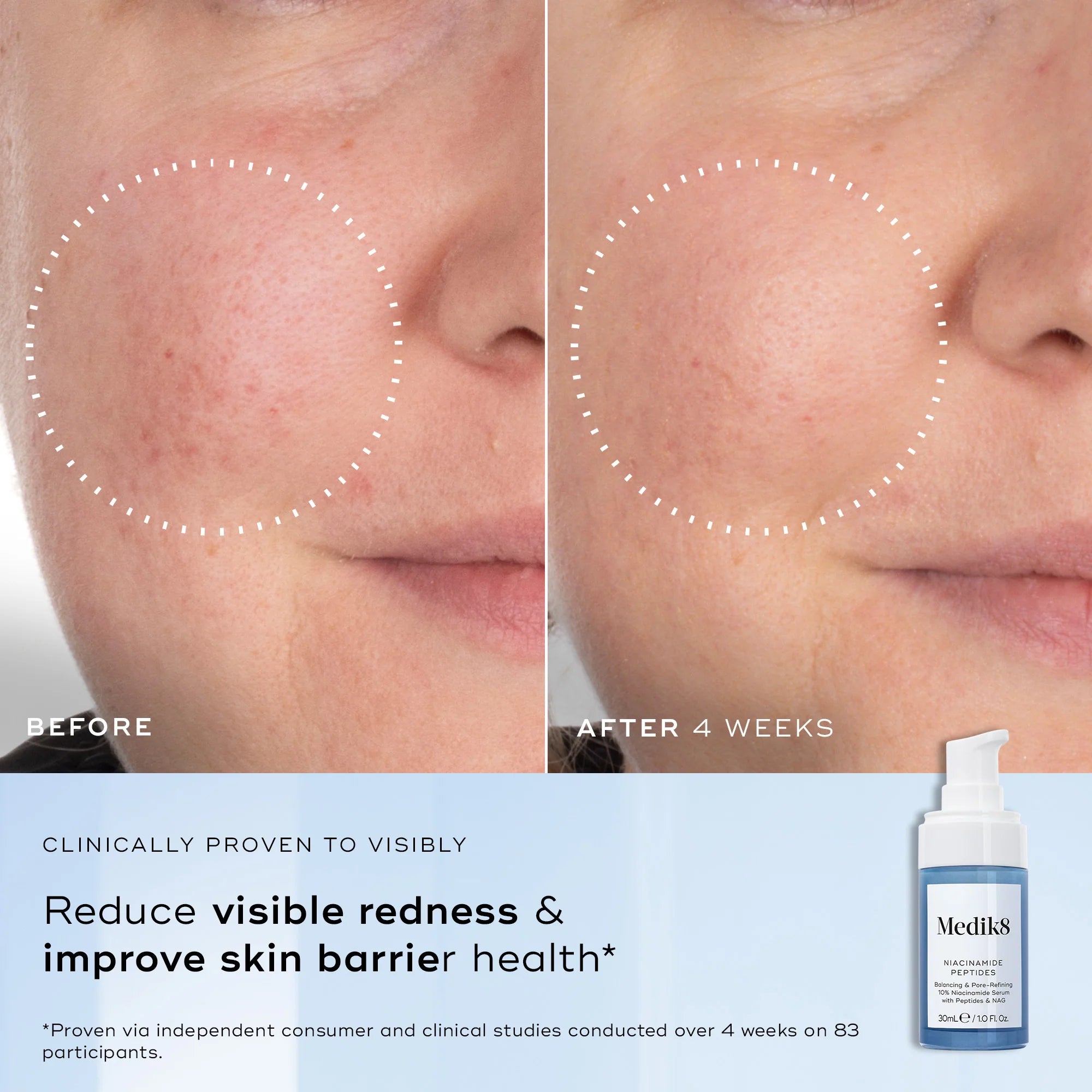 Niacinamide Peptides 5