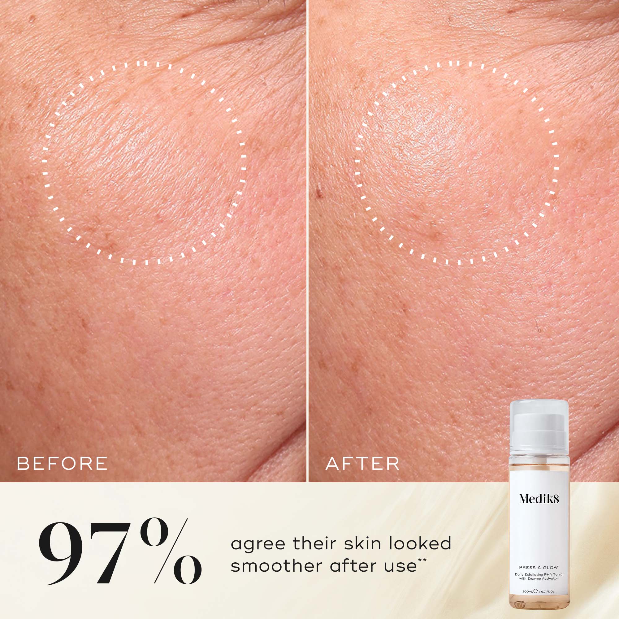 Press & Glow® 5