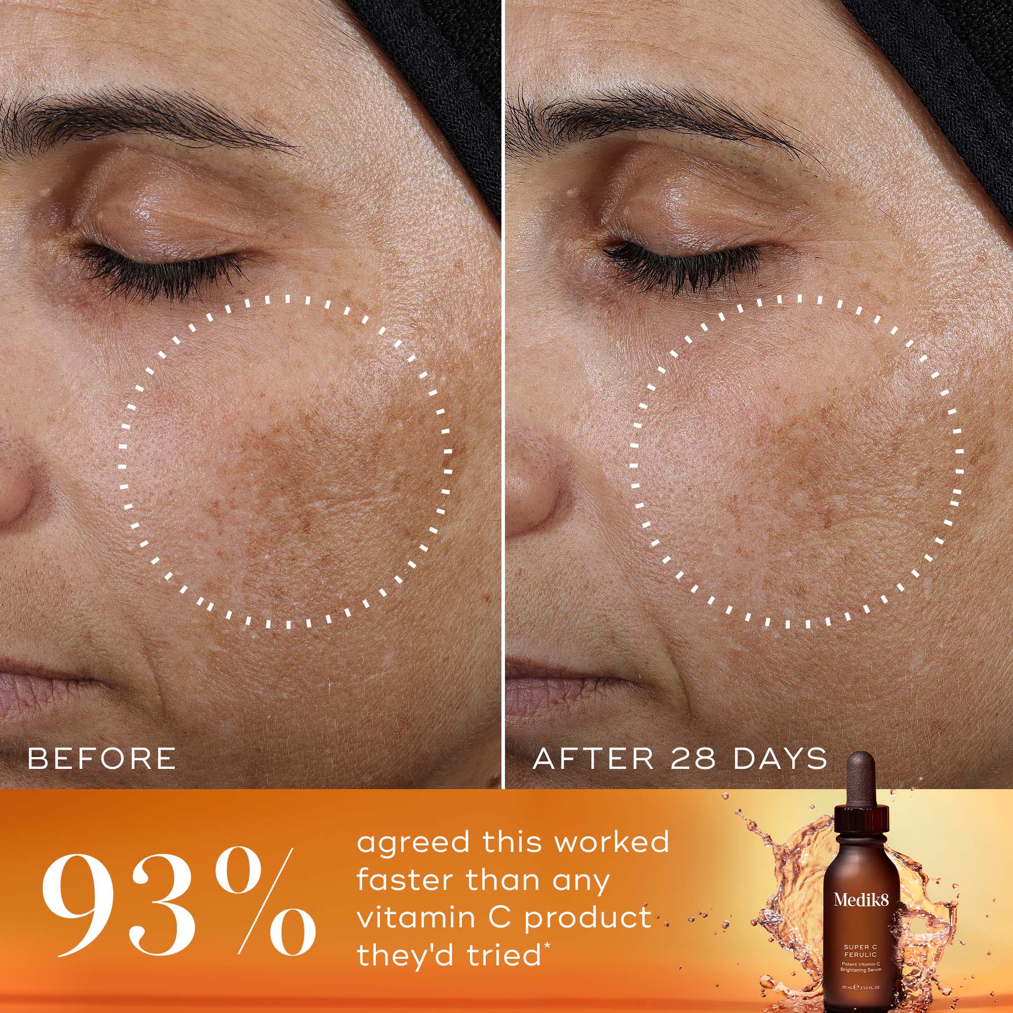 Super C Ferulic™ 5