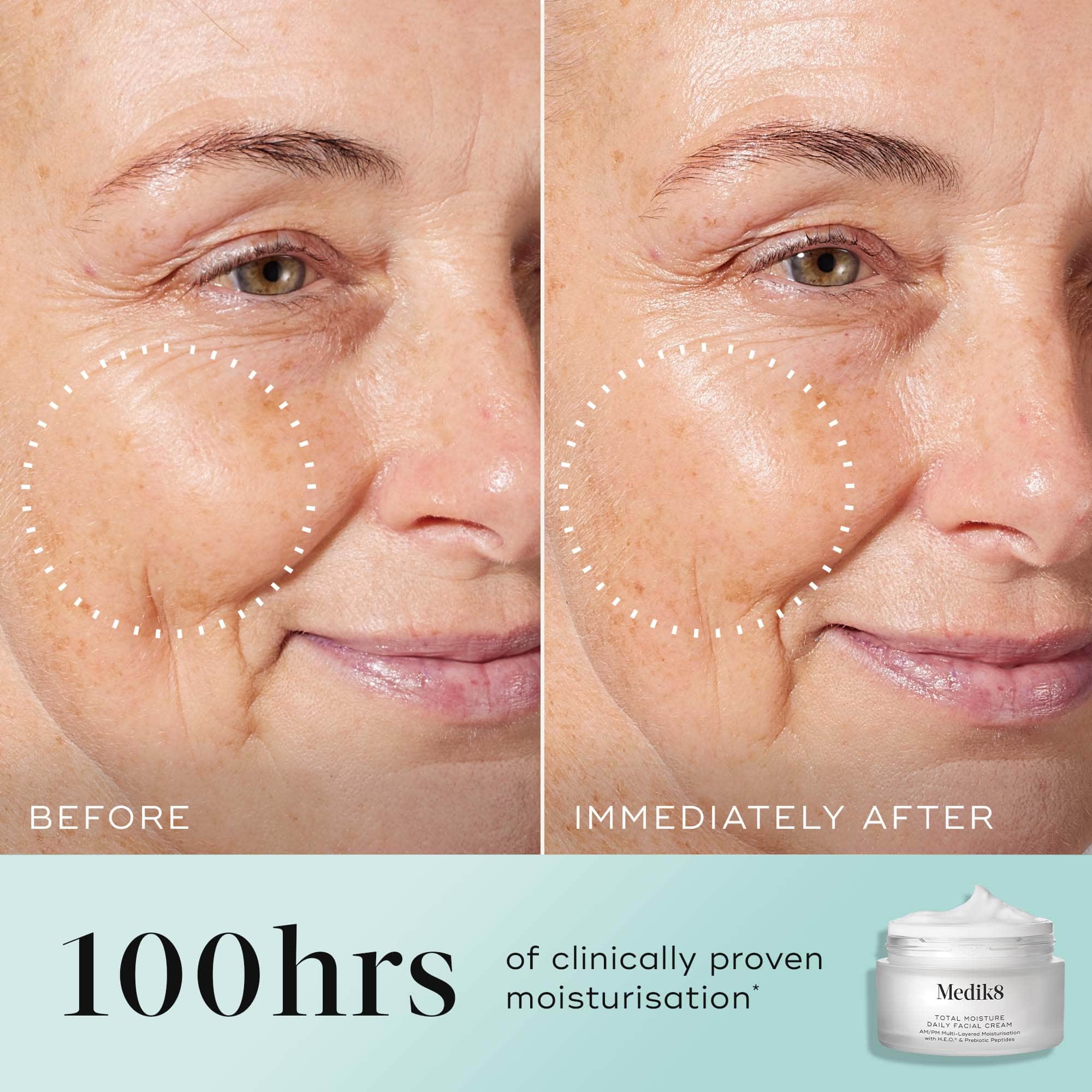 Total Moisture Daily Facial Cream™ (Travel Size) 6